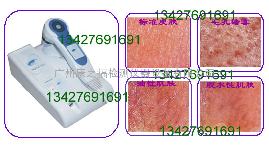 康之福厂家皮肤检测仪|皮肤分析仪|皮肤观察仪|皮肤诊断仪|皮肤检测仪|皮肤分析仪|皮肤测试仪|皮肤仪