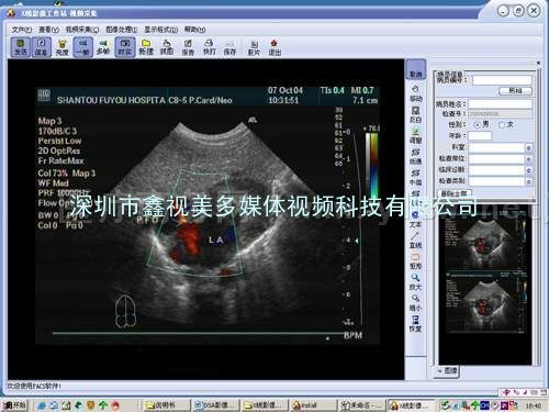 超声医学软件+专业视频采集卡