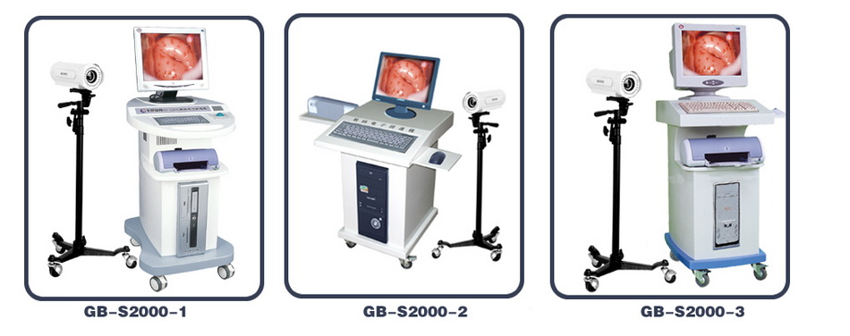 数码电子阴道镜（索尼CCD)