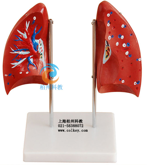 人体肺部解剖模型,肺解剖教学模型