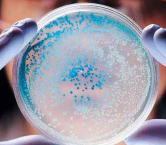 深圳食品检测第三方机构供应食品微生物中的致病菌检测