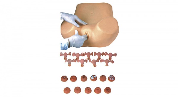康谊牌KAY-FS高级妇科检查模型 宫颈模型