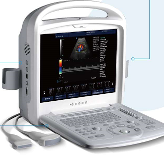 便携彩超全数字彩色多普勒超声诊断仪台式彩超